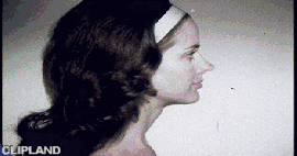 animated gif of Albolene Skin Cream(Product) "Split Face" (1964)