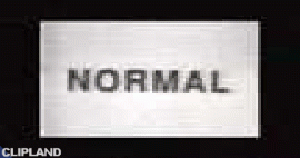 animated gif of Normal